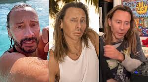 Bob Sinclar, cos'è successo al viso? Fan divisi tra botox e trovata di  marketing