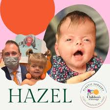 UMMC Pediatric Plastic Surgery