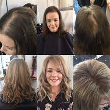 Total Transformation For Our Lady Steph Who Went For A Full Hair Replacement System And Hair Replacement Systems Hairstyles For Thin Hair Mens Hair Extensions