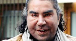 Alejandra guzmán no tiene próximos conciertos programados por ahora. 10 Personas Que Quedaron Peor Que Alejandra Guzman Con Tanta Cirugia Fotos El Heraldo De Mexico