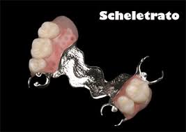 Dentiera che si rompe 61 significato del sogno: Dentiera Tutto Cio Che Devi Sapere Per Tornare A Sorridere Dentista Resta