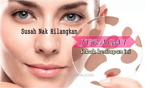 Ingin cepat menghilangkan jerawat tapi takut dan mahal? Kenapa Jeragat Susah Hilang Ini Penyelesaiannya Ohcantik Com