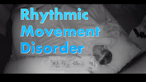Rhythmic Movement Disorder: Sleep Parasomnia Case Study, and some Fun