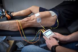 Image result for Electrical Stimulation Therapy