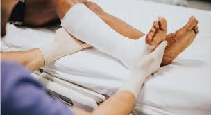 Mereka adalah masalah biasa di kalangan wanita tua atau hamil kerana pengaruh hormon, dan mereka cenderung berkembang vena varikos selalu merupakan gejala gangguan kekurangan vena yang mendasari. 10 Fakta Berkenaan Varicose Veins Myumaimah Com