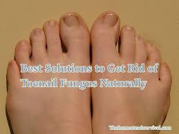 Best Solutions To Get Rid Of Toenail Fungus Naturally The Homestead Survival In 2020 Toenail Fungus Brittle Toenails Toe Nails