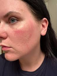 What to do with a 21-year-old Asperger's child who is getting violent?