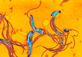 Image result for Spirochete