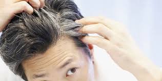 Recoloring hair involves using a colored dye evenly over the entire head. Live Chennai The Reasons For White Hair At Young Age Reasons For White Hair At Young Age Health Tips Hair Care Main Reason For Graying Hair Daily Tips