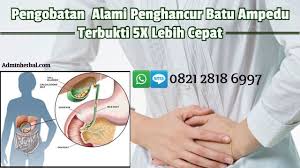 Radang Tenggorokan Atau Faringitis Adalah Sakit Tenggorokan Yang Disebabkan Oleh Radang Bagian Belakang Tenggorokan Atau Yan Obat Alami Sakit Tenggorokan Medis