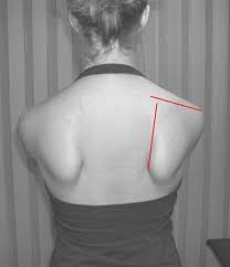 I have been successful and now the track my claim page reads 'validated' does this mean it is the last phase per say and i shall be recieving my ear buds soon? How To Properly Permanently Resolve Scapular Dyskinesis Msk Neurology