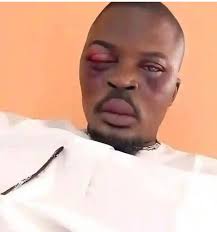 When did you last get sweet revenge?😳