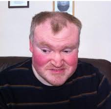 Help toward funeral and memorial costs for disabled brother who died of  malpractice