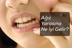 Agiz Yarasina Ne Iyi Gelir Saglik Saglikli Yasam Tarzi Saglikli Olmak