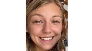 Albany Topic Bret Edge