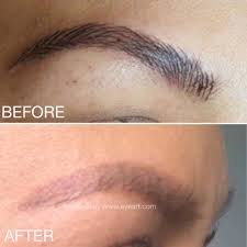 Check spelling or type a new query. Best Way To Remove Eyebrow Tattoo Eyebrowshaper