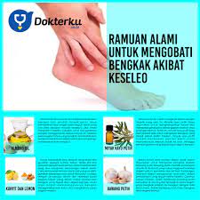 Keseleo atau sering juga disebut dengan urat terkilir, salah urat dan yang sebagainya ini terjadi pada pergelangan kaki atau pergelangan tangan. Ramuan Alami Untuk Mengobati Bengkak Akibat Keseleo Dokterku Co Id