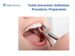 Image result for Tooth Extraction