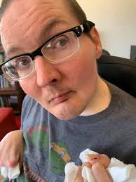 Why is my autistic son banging his chin