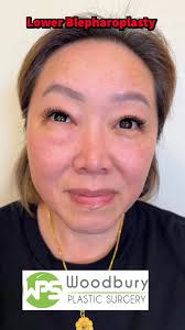 Dr. Charles Vang is a Family Practice Physician in MN since 2017. Dr.  Charles will be there at the health fair to answer any medical questions.  Hope to see y'all there. #hmahealthfair2025 #