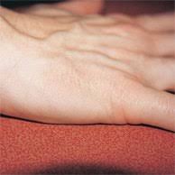 Adesea iritatia apare sub inele din cauza sapunului. Tratament Eczema Gloves In A Bottle