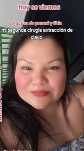 Tibia Y Perone Ponen Clavos