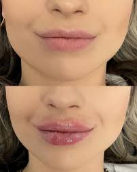 Brightside Aesthetics