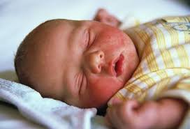 Tapi jangan lap, cuma 'dab dab' sahaja. A Ruam Di Muka Bayi Isyarat Sos Daripada Badan