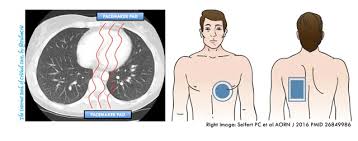 Image result for Transcutaneous Pacing