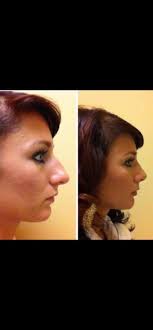 Getting Ready For The BIG DAY😱