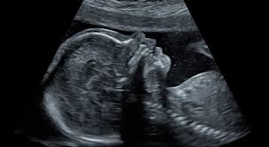 Beim babyfernsehen (das ab 2021 verboten wird) setzt du deinem baby unnötiger strahlung aus, um es zu sehen. Ultraschalldiagnostik Im 2 Und 3 Schwangerschaftsdrittel