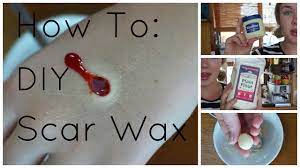 Make sure you're in no rush. How To Diy Nose And Scar Wax Youtube