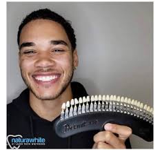 Cotswold Teeth Whitening