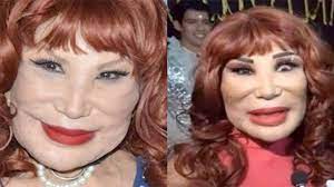 Sus malas decisiones con las cirugías ¿cómo se veía la vedette antes de todas las cirugías en el rostro? Lyn May Muestra Su Nuevo Rostro Tras Nueva Cirugia Y Asi Luce Radio Turquesa Noticias