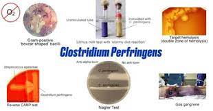 Clostridium tertium displays resistance to third generation cephalosporins (83% resistance to ceftriaxone) (3, 21, 27). Clostridium Perfringens Properties Diseases Diagnosis Microbe Online