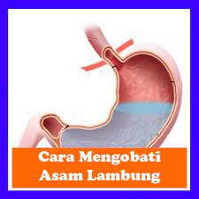Look through examples of asam lambung translation in sentences, listen to pronunciation and learn grammar. Cara Mengobati Asam Lambung Para Android Apk Baixar