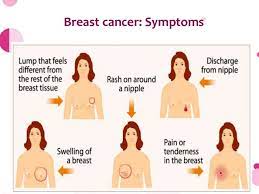 Read about different tests, prevention and early signs. Breast Cancer Awareness And Prevention