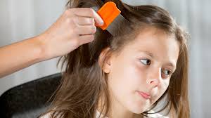 Experts say schools overreact to head lice