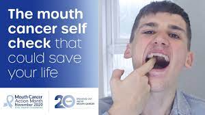 Sore in the mouth that doesn't heal (the most common symptom) white or red patch on the gums, tongue, tonsils, or lining of the mouth How To Spot Mouth Cancer Oral Health Foundation