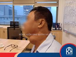 Tuyến giáp là một tuyến nằm trước cổ tiết ra hormone và được vận chuyển đến các tế bào cơ thể thông qua các mạch máu và giúp điều chỉnh nhiệt độ cơ thể phù hợp môi trường, giữ cho não luôn minh mẫn, tim đập đều. Vet Háº¡ch Cá»• Kich ThÆ°á»›c Lá»›n Cho Bá»‡nh Nhan Ung ThÆ° Tuyáº¿n Giap Di CÄƒn