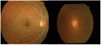 Diagram Of Fundus Wiring Diagram General Helper