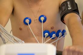 Im regelfall lassen sie diese elektroden beim arzt anlegen und tragen sie 24 stunden lang. Ergometrie Das Belastungs Oder Stress Ekg