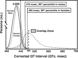 diagnostic miscues in congenital long qt syndrome circulation