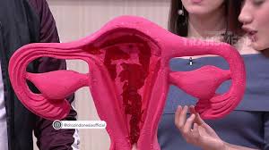 Penyebab sakit pinggang sebelah kiri yang pertama adalah otot tegang. Dr Oz Menstruasi Yang Sakit Sampai Pingsan 13 5 18 Part 3 Youtube
