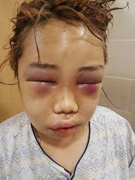 Soft to the touch, chic for a night out or chill day look. 14 Year Old Korean Girl Brutally Attacked By 5 Students