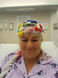 Living with epilepsy and its challenges