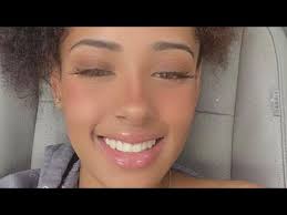 Young woman hit by two cars in North Texas