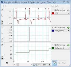 how can i use labcharts spike histogram module to detect