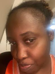 My hair is so hard to comb 😥.. I tried coconut oil but it's not helping..