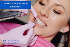 Can porcelain veneers be removed?